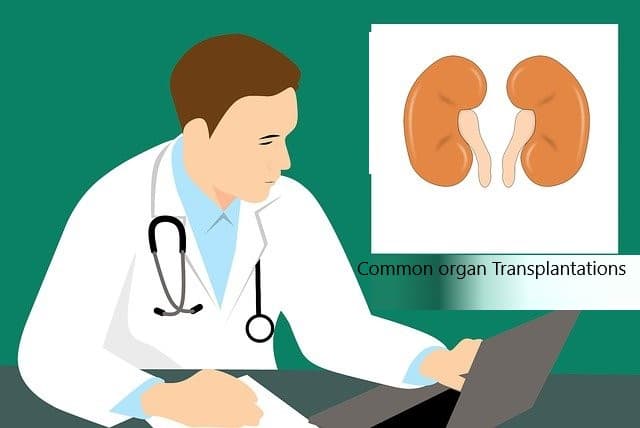 Common Examples of organ Transplantations-Eduinput