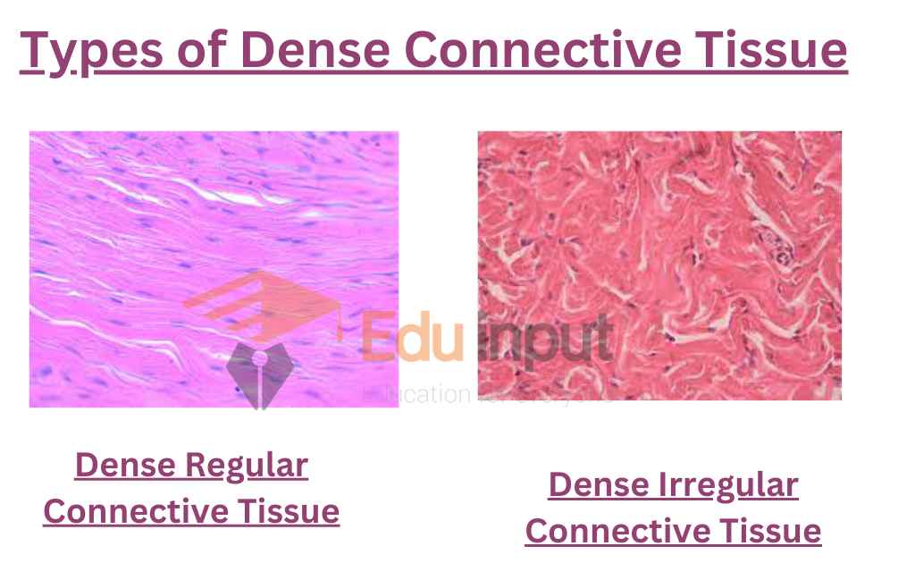 image showing types of dense connective tissues