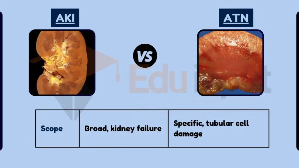 Image showing Difference Between AKI and ATN
