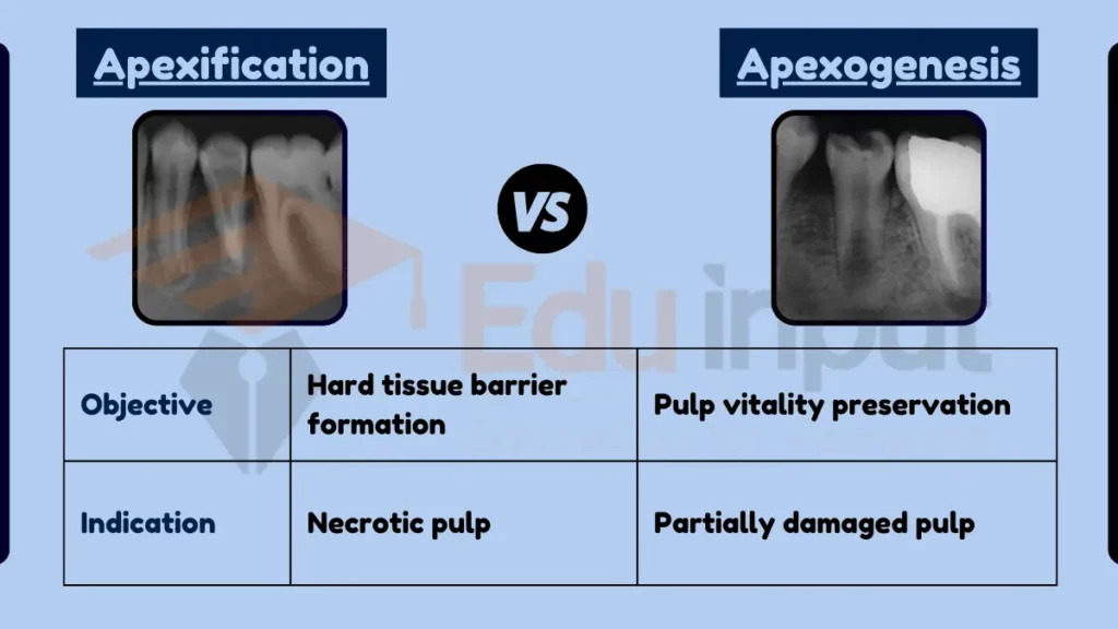 Image showing Difference Between Apexification and Apexogenesis