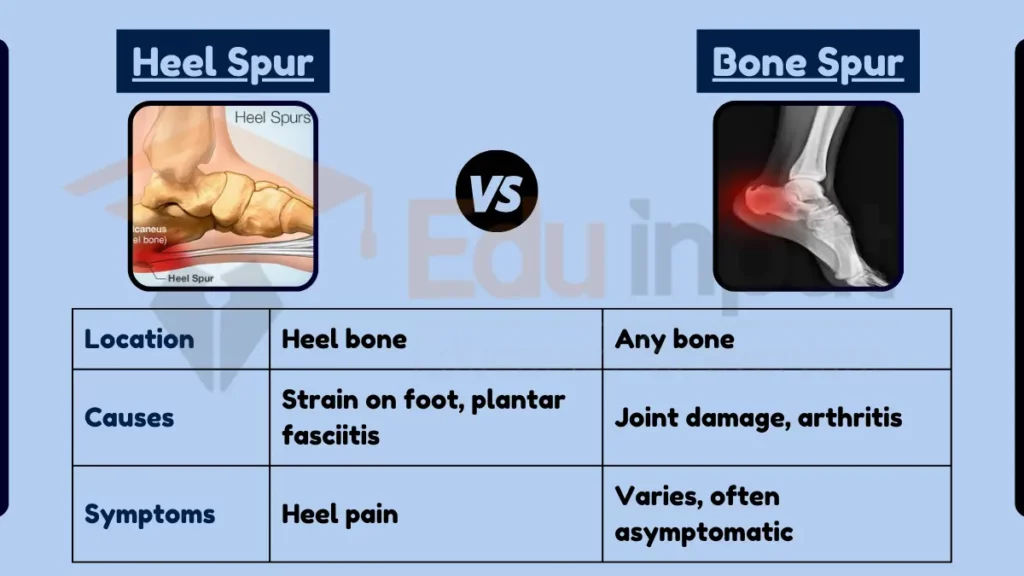 Image showing Difference Between Heel Spur and Bone Spur