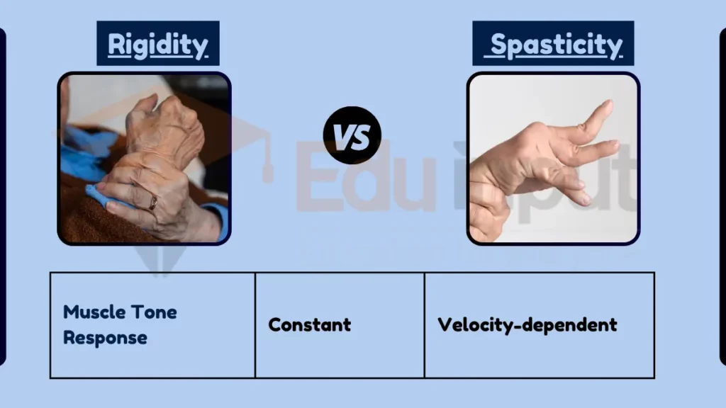 Image showing Difference Between Rigidity and Spasticity