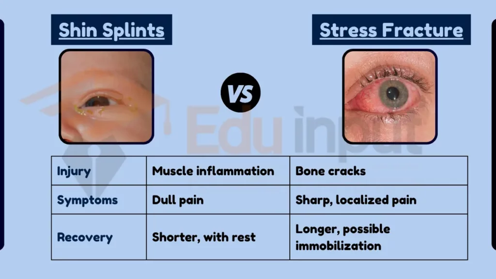 Image showing Difference Between Shin Splint and Stress Fracture