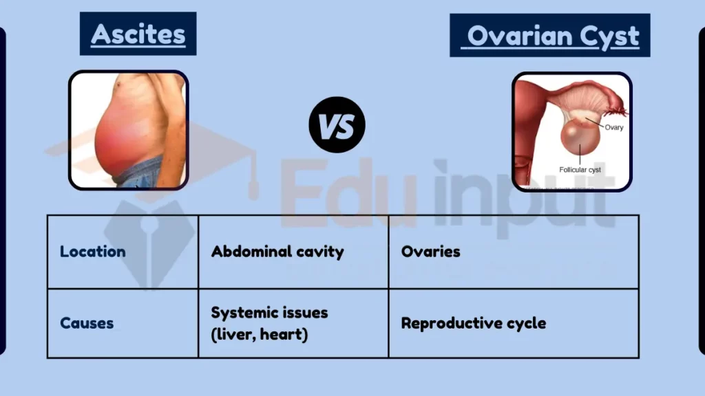 image showing Difference Between Ascites and Ovarian Cyst