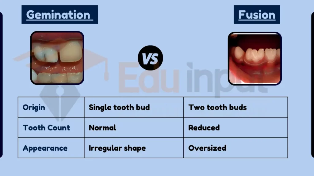 image showing Difference Between Gemination and Fusion