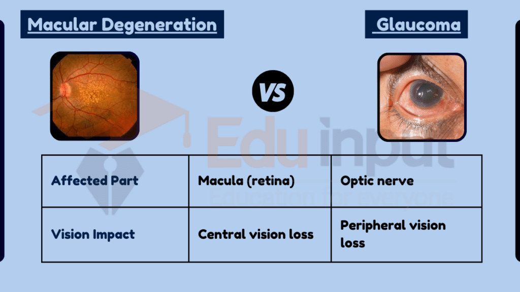 image showing Difference Between Macular Degeneration and Glaucoma