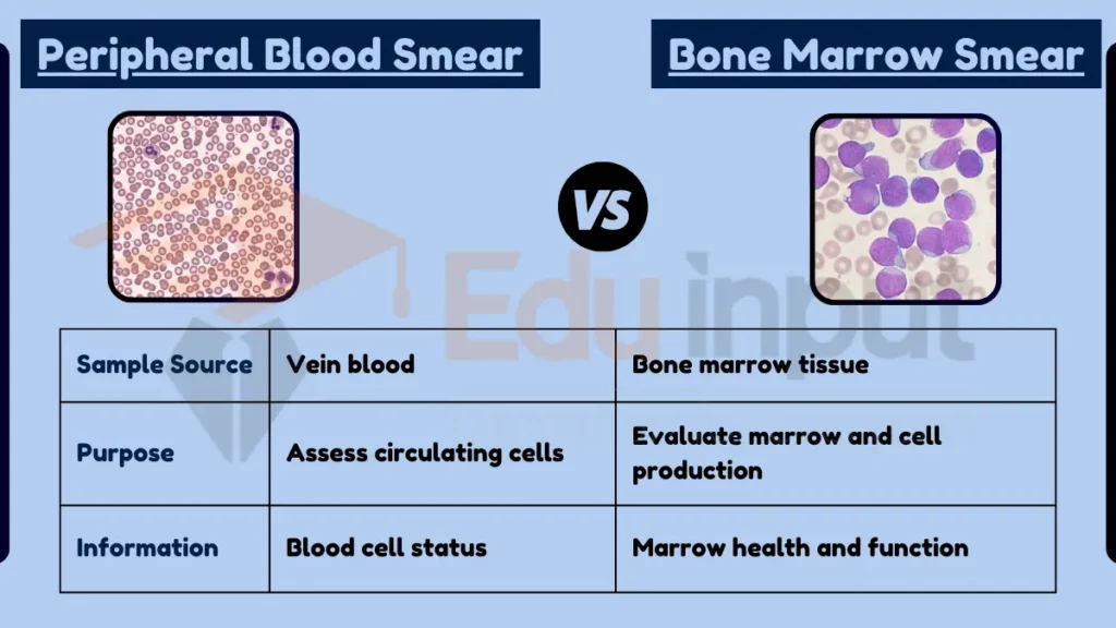 Image showing Difference Between Peripheral Blood Smear and Bone Marrow Smear