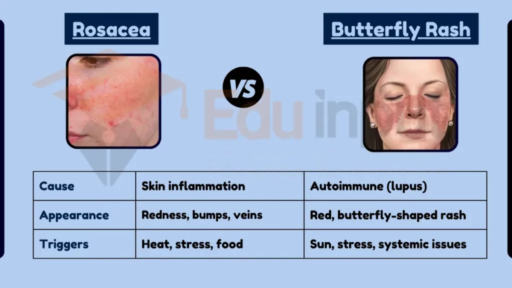 Image showing Difference Between Rosacea and Butterfly Rash?