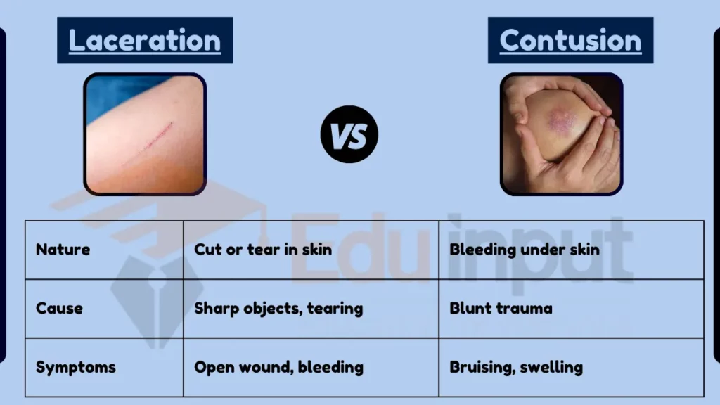 image showing Difference Between Laceration and Contusion