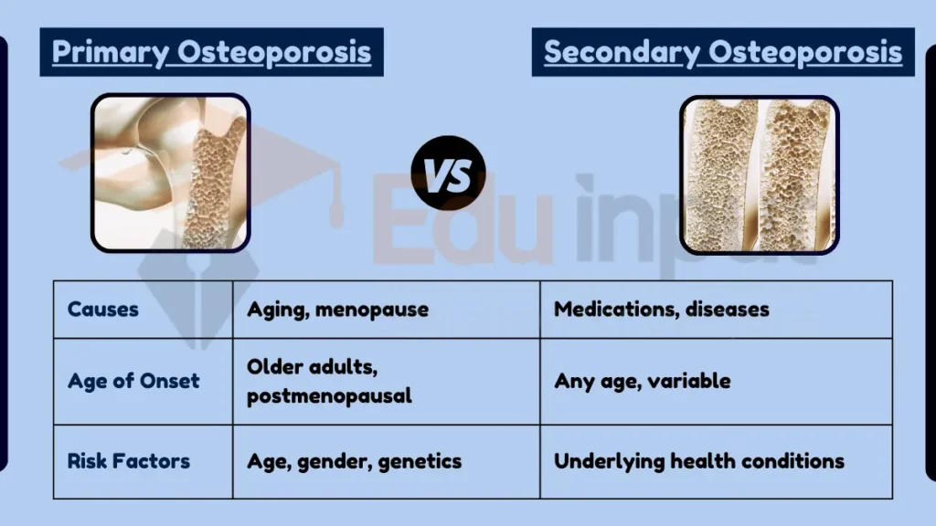 image showing Difference Between Primary and Secondary Osteoporosis