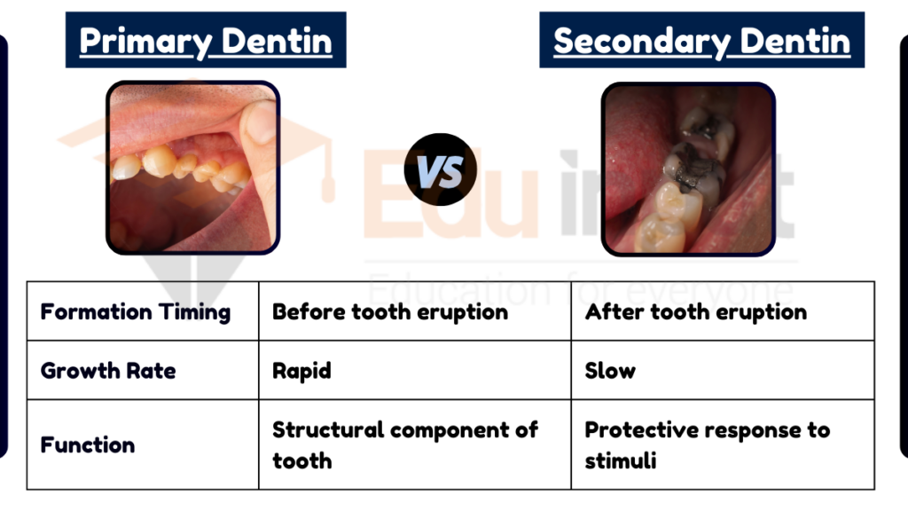 image showing Difference Between Primary and Secondary Dentin