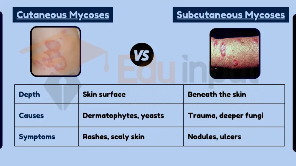 image showing Difference Between Cutaneous and Subcutaneous Mycoses