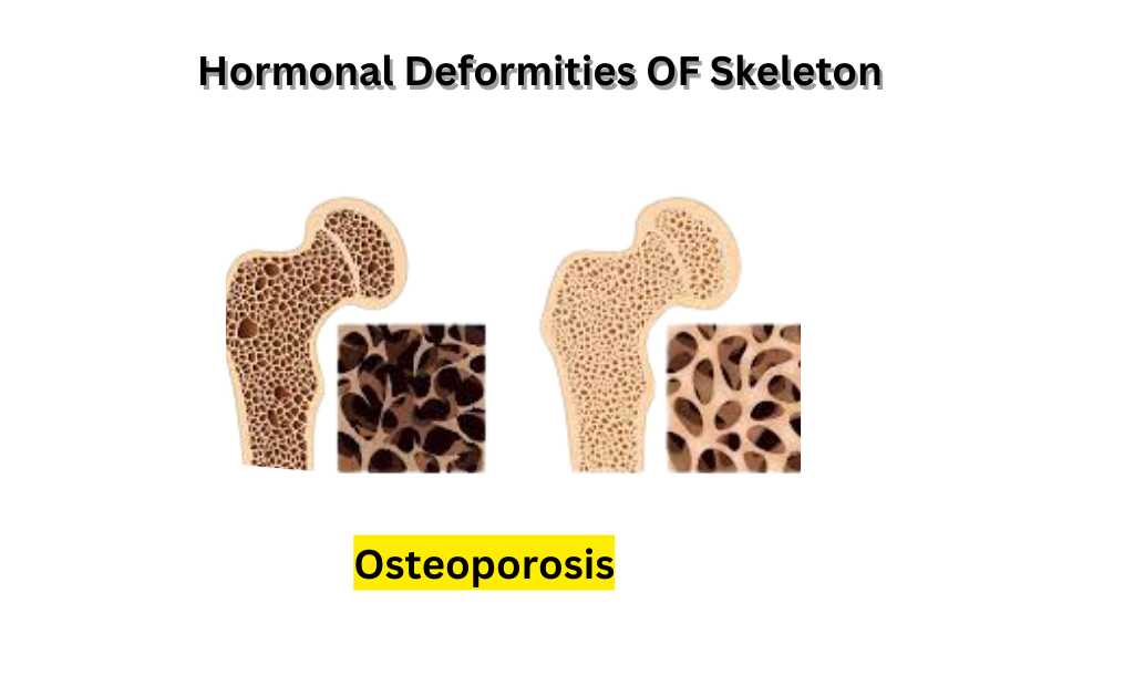 image showing Hormonal Deformities