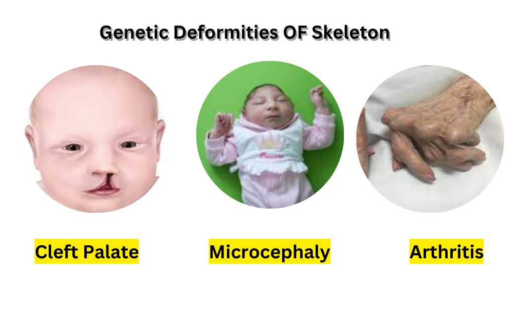 image showing Genetic-Deformities-