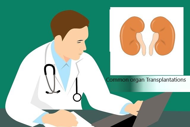 7 Common organ Transplantations-Eduinput